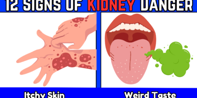 12 ALARMING Signs Your Kidneys May Be In DANGER