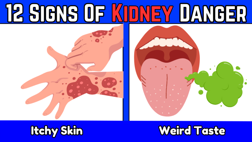 12 ALARMING Signs Your Kidneys May Be In DANGER