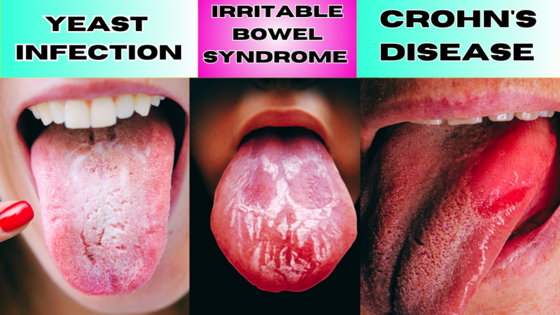 7 Signs of Tongue you should look out for