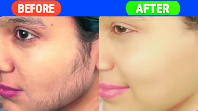 How to remove facial hair naturally