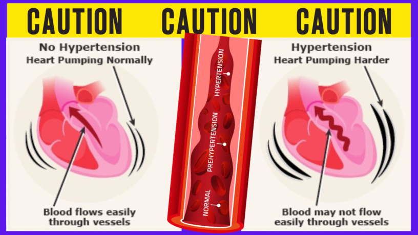 High Blood Pressure Foods to Avoid