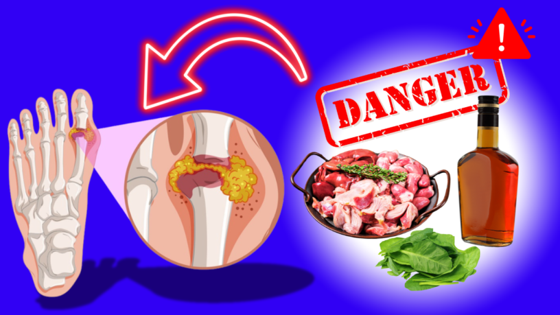 Avoid these Foods If you have Gout: