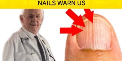 6 Main Reasons Why Vertical Streaks May Appear on Your Nails