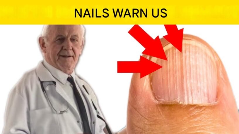 6 Main Reasons Why Vertical Streaks May Appear on Your Nails